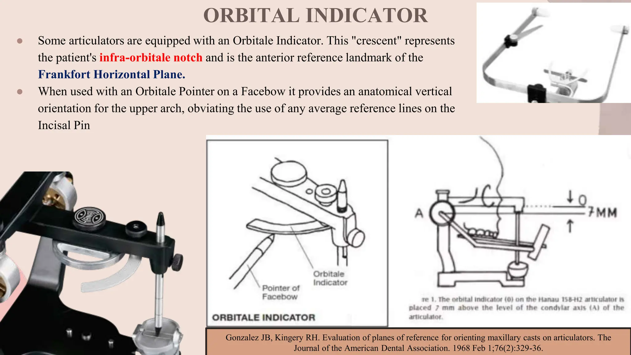 ORBITAL INDICATOR
● Some articulators are equipped with an Orbitale Indicator. This "crescent" represents
the patient's infra-orbitale notch and is the anterior reference landmark of the
Frankfort Horizontal Plane.
● When used with an Orbitale Pointer on a Facebow it provides an anatomical vertical
orientation for the upper arch, obviating the use of any average reference lines on the
Incisal Pin
Gonzalez JB, Kingery RH. Evaluation of planes of reference for orienting maxillary casts on articulators. The
Journal of the American Dental Association. 1968 Feb 1;76(2):329-36.
 