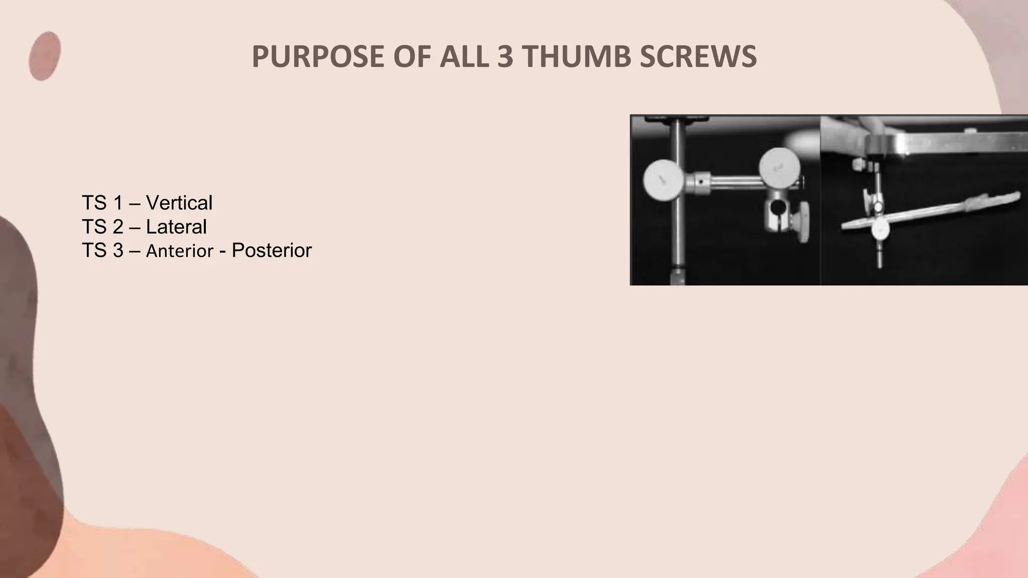 PURPOSE OF ALL 3 THUMB SCREWS
TS 1 – Vertical
TS 2 – Lateral
TS 3 – Anterior - Posterior
 