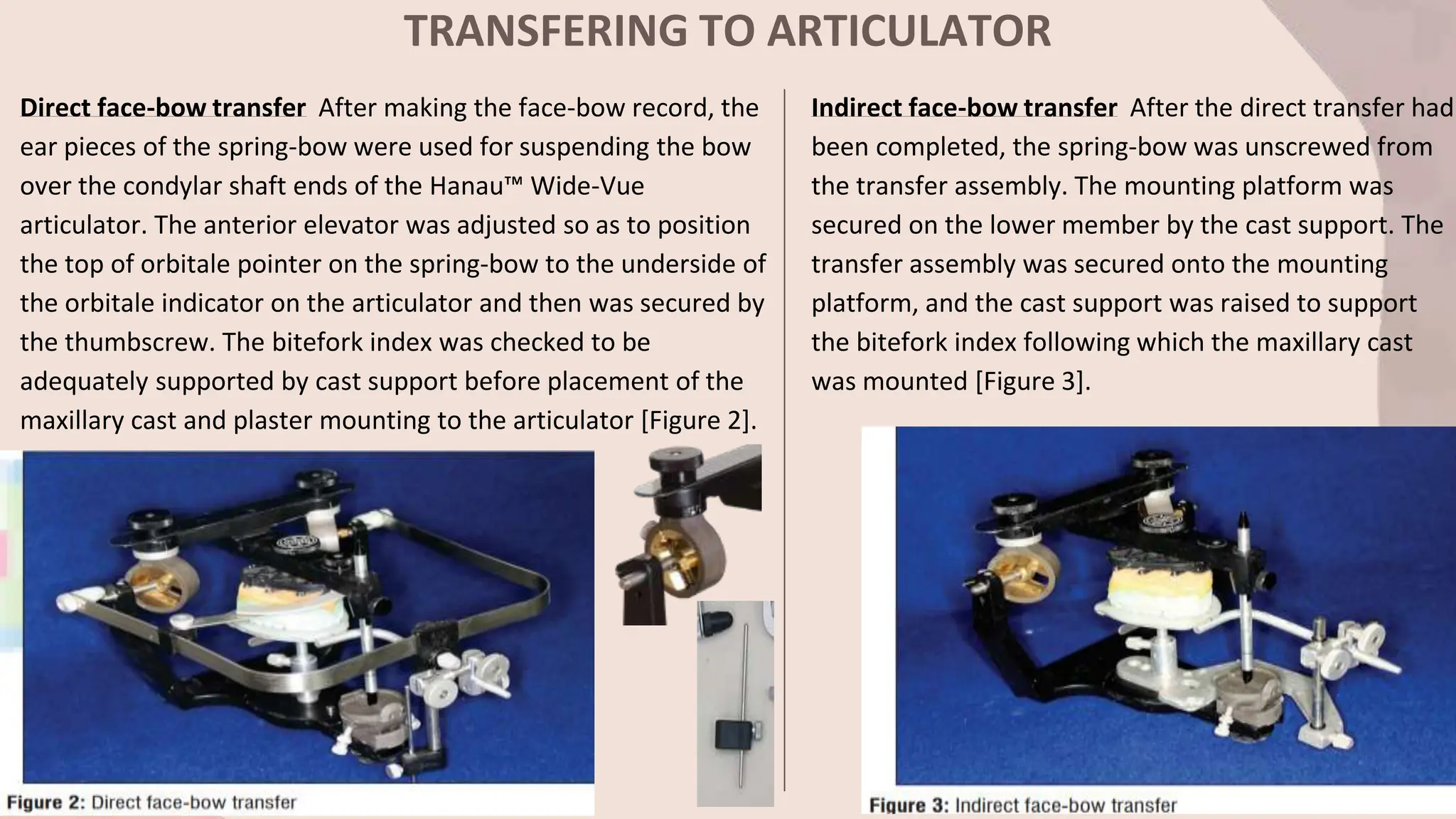 TRANSFERING TO ARTICULATOR
Direct face-bow transfer After making the face-bow record, the
ear pieces of the spring-bow were used for suspending the bow
over the condylar shaft ends of the Hanau™ Wide-Vue
articulator. The anterior elevator was adjusted so as to position
the top of orbitale pointer on the spring-bow to the underside of
the orbitale indicator on the articulator and then was secured by
the thumbscrew. The bitefork index was checked to be
adequately supported by cast support before placement of the
maxillary cast and plaster mounting to the articulator [Figure 2].
Indirect face-bow transfer After the direct transfer had
been completed, the spring-bow was unscrewed from
the transfer assembly. The mounting platform was
secured on the lower member by the cast support. The
transfer assembly was secured onto the mounting
platform, and the cast support was raised to support
the bitefork index following which the maxillary cast
was mounted [Figure 3].
 