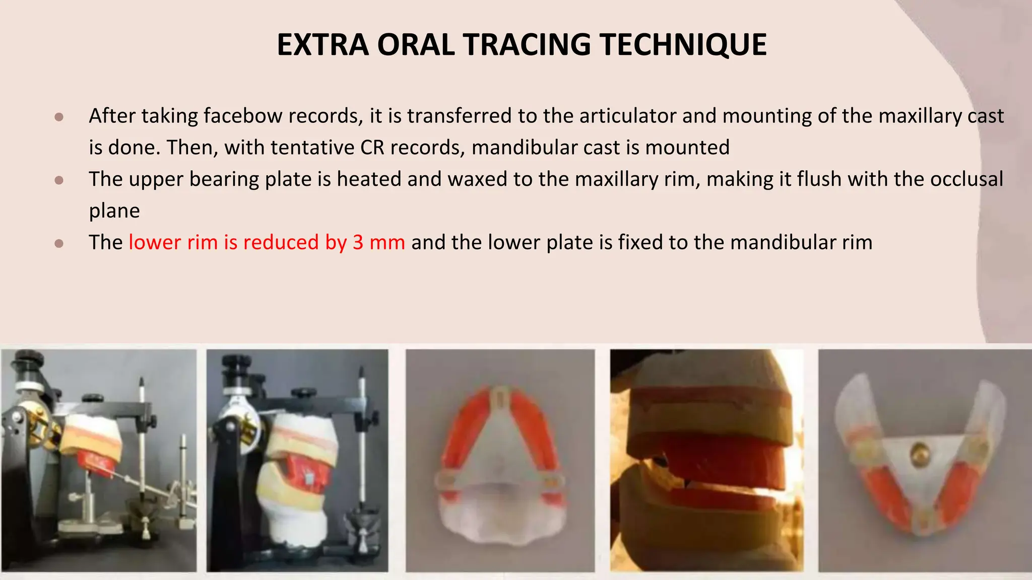EXTRA ORAL TRACING TECHNIQUE
● After taking facebow records, it is transferred to the articulator and mounting of the maxillary cast
is done. Then, with tentative CR records, mandibular cast is mounted
● The upper bearing plate is heated and waxed to the maxillary rim, making it flush with the occlusal
plane
● The lower rim is reduced by 3 mm and the lower plate is fixed to the mandibular rim
 
