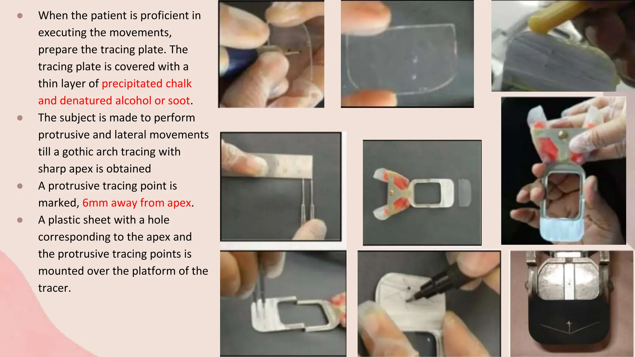 ● When the patient is proficient in
executing the movements,
prepare the tracing plate. The
tracing plate is covered with a
thin layer of precipitated chalk
and denatured alcohol or soot.
● The subject is made to perform
protrusive and lateral movements
till a gothic arch tracing with
sharp apex is obtained
● A protrusive tracing point is
marked, 6mm away from apex.
● A plastic sheet with a hole
corresponding to the apex and
the protrusive tracing points is
mounted over the platform of the
tracer.
 