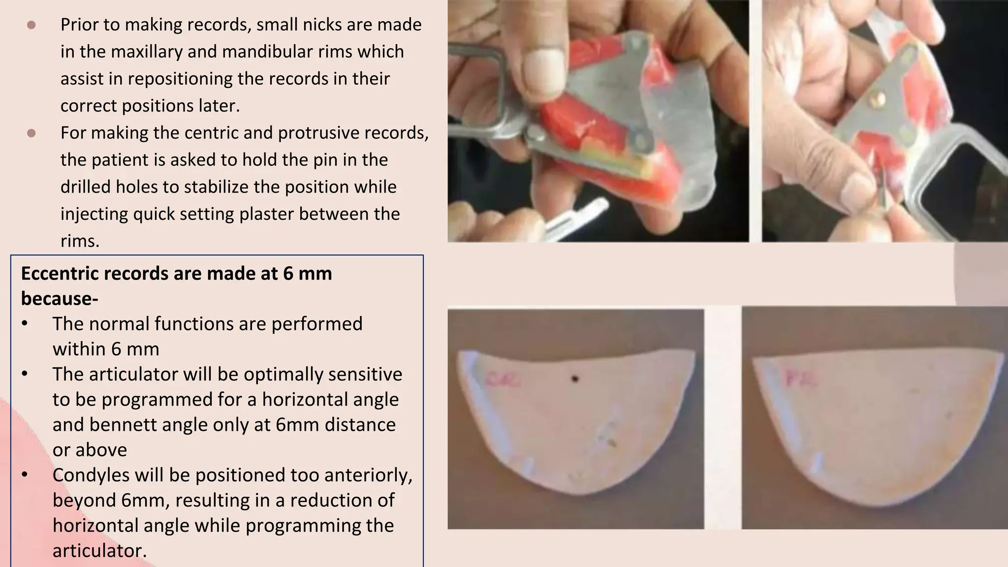 ● Prior to making records, small nicks are made
in the maxillary and mandibular rims which
assist in repositioning the records in their
correct positions later.
● For making the centric and protrusive records,
the patient is asked to hold the pin in the
drilled holes to stabilize the position while
injecting quick setting plaster between the
rims.
Eccentric records are made at 6 mm
because-
• The normal functions are performed
within 6 mm
• The articulator will be optimally sensitive
to be programmed for a horizontal angle
and bennett angle only at 6mm distance
or above
• Condyles will be positioned too anteriorly,
beyond 6mm, resulting in a reduction of
horizontal angle while programming the
articulator.
 