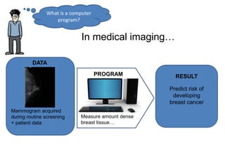 What is a computer
program?
In medical imaging…
DATA
Measure amount dense
breast tissue…
PROGRAM
Predict risk of
developing
breast cancer
RESULT
Mammogram acquired
during routine screening
+ patient data
 