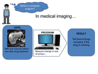 What is a computer
program?
In medical imaging…
DATA
Measure change in size
of tumour…
PROGRAM
Tell doctor/drugs
company if the
drug is working
RESULT
MRI liver tumours before
and after drug treatment
 