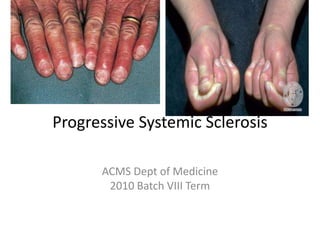 Progressive Systemic Sclerosis
ACMS Dept of Medicine
2010 Batch VIII Term
 