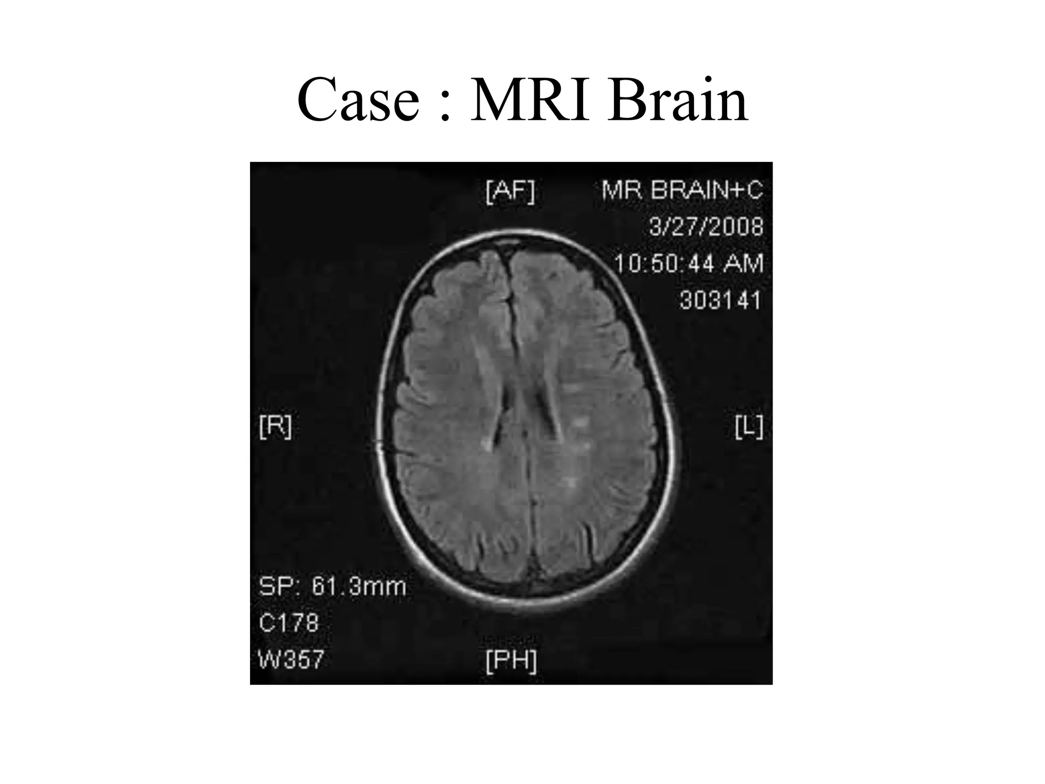 Case : MRI Brain
 
