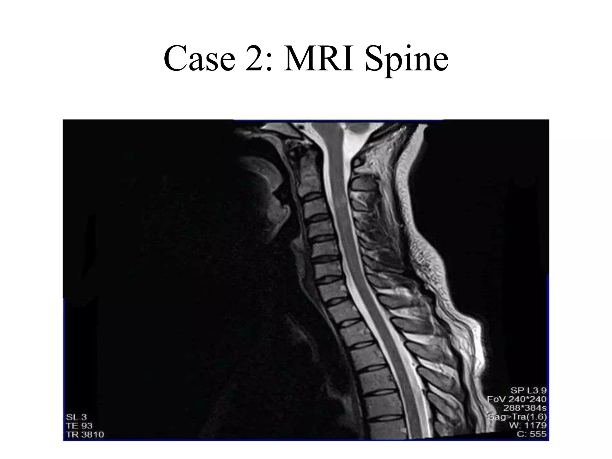 Case 2: MRI Spine
 