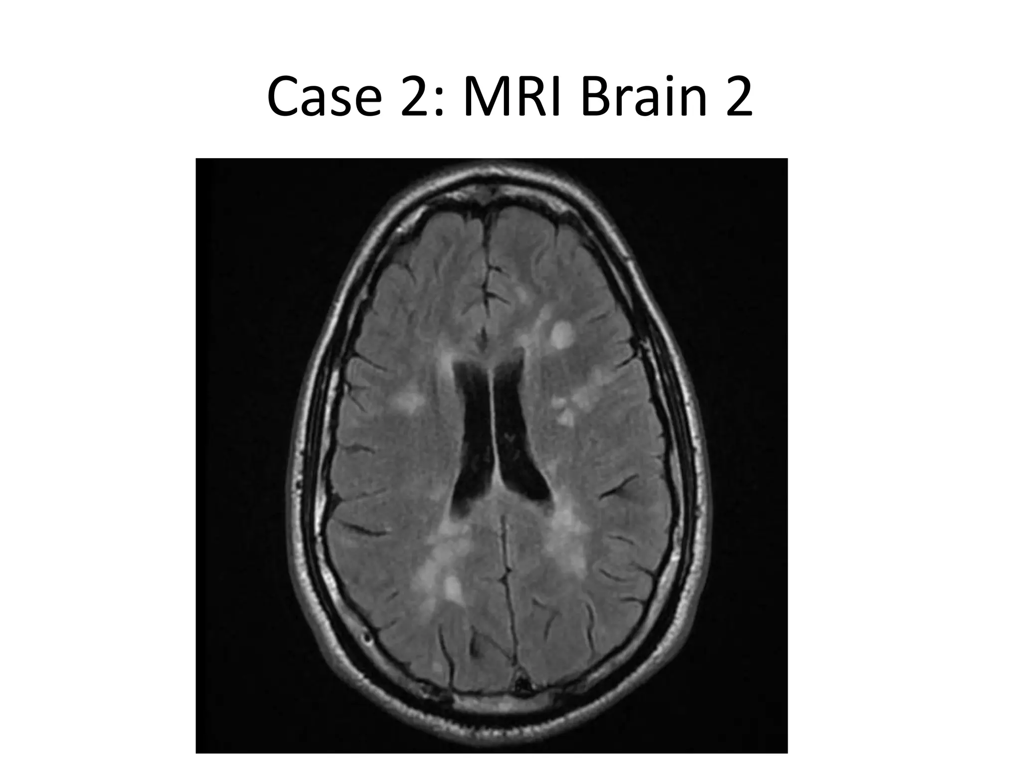 Case 2: MRI Brain 2
 
