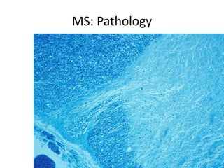 MS: Pathology
 