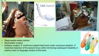 Awak Mathok Progress in neuroanesthesia | PPTX