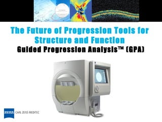 Guided Progression Analysis™ (GPA) The Future of Progression Tools for  Structure and Function  