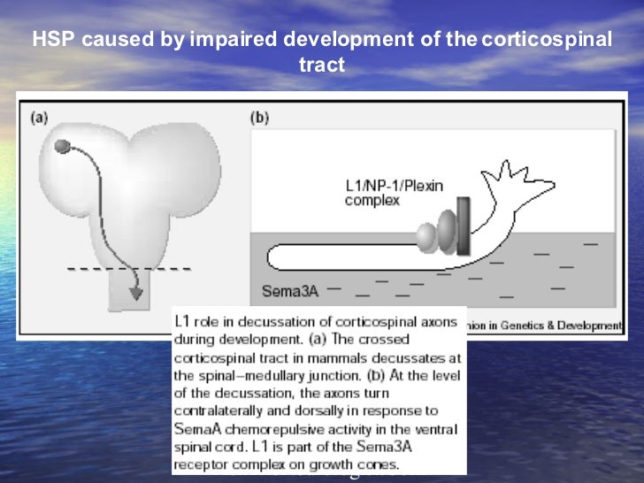 Progressive Spastic Paraparesis