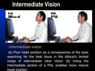 Intermediate Vision
Intermediate vision:
(a) Poor head position as a consequence of the eyes
searching for the best focus in the bifocal’s limited
range of intermediate clear vision. (b) Using the
intermediate portion of a PAL enables more natural
head position.
(a)
Bifocal
(b)
PAL
 