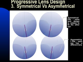 Progressive Lens Design
3. Symmetrical Vs Asymmetrical
Symmetrical
PAL - same
lens design
is rotated to
fit the other
eye
Asymmetrica
l PAL - each
eye has a
different lens
 