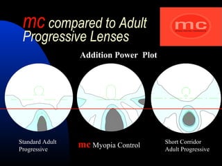 mc compared to Adult
Progressive Lenses
Addition Power Plot
mc Myopia Control
Standard Adult
Progressive
Short Corridor
Adult Progressive
 