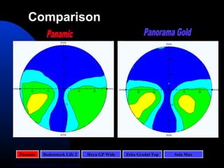 Panamic Rodenstock Life 2 Hoya GP Wide Zeiss Gradal Top Sola Max
Analyzed by Rotlex Class I on a random lens
Comparison
 