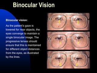 Binocular Vision
Binocular vision:
As the patient’s gaze is
lowered for near objects, the
eyes converge to maintain a
single binocular image. The
progressive lenses should
ensure that this is maintained
for different object distances
from the eyes, as illustrated
by the lines.
 