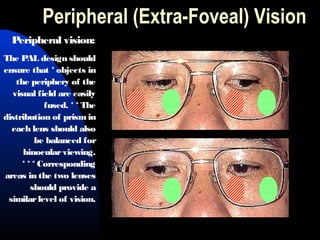 Peripheral (Extra-Foveal) Vision
Peripheral vision:
The PAL design should
ensure that * objects in
the periphery of the
visual field are easily
fused. * * The
distribution of prismin
each lens should also
be balanced for
binocularviewing.
* * * Corresponding
areas in the two lenses
should provide a
similarlevel of vision.
 
