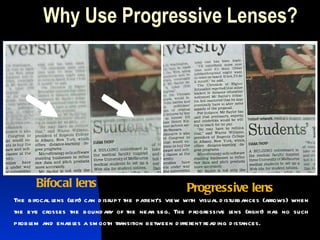 Why Use Progressive Lenses? Bifocal   lens Progressive lens The bifocal lens (left) can disrupt the patient’s view with visual disturbances (arrows) when the eye crosses the boundary of the near seg. The progressive lens (right) has no such problem and enables a smooth transition between different reading distances. 