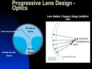 Progressive Lens Design - Optics Distance Zone Near  Zone Umbilical line Intermediate  Zone Lens Radius Changes Along Umbilical Line 