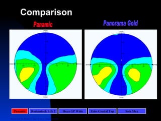 Panamic Panamic Rodenstock Life 2 Hoya GP Wide Zeiss Gradal Top Sola Max Analyzed by Rotlex Class I on a random lens Panorama Gold Comparison 