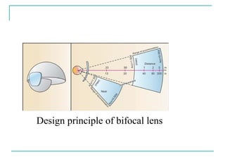 Design principle of bifocal lens
 