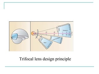 Trifocal lens design principle
 