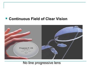  Continuous Field of Clear Vision
No line progressive lens
 
