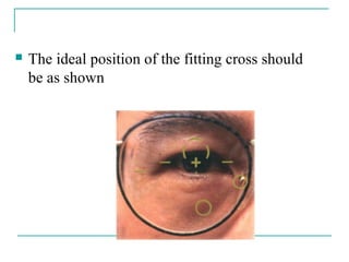  The ideal position of the fitting cross should
be as shown
 