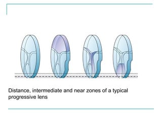 Distance, intermediate and near zones of a typical
progressive lens
 