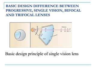 BASIC DESIGN DIFFERENCE BETWEEN
PROGRESSIVE, SINGLE VISION, BIFOCAL
AND TRIFOCAL LENSES
Basic design principle of single vision lens
 