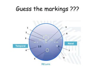 Guess the markings ???
 