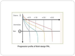 Progression profile of Multi design PAL
 