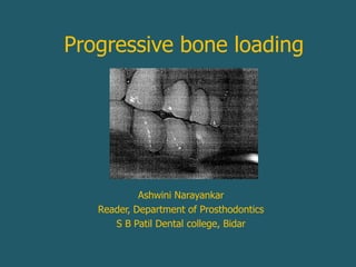 Progressive bone loading
Ashwini Narayankar
Reader, Department of Prosthodontics
S B Patil Dental college, Bidar
 