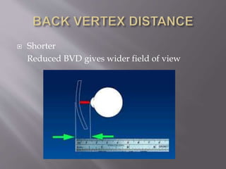Progressive lens dispensing | PPTX