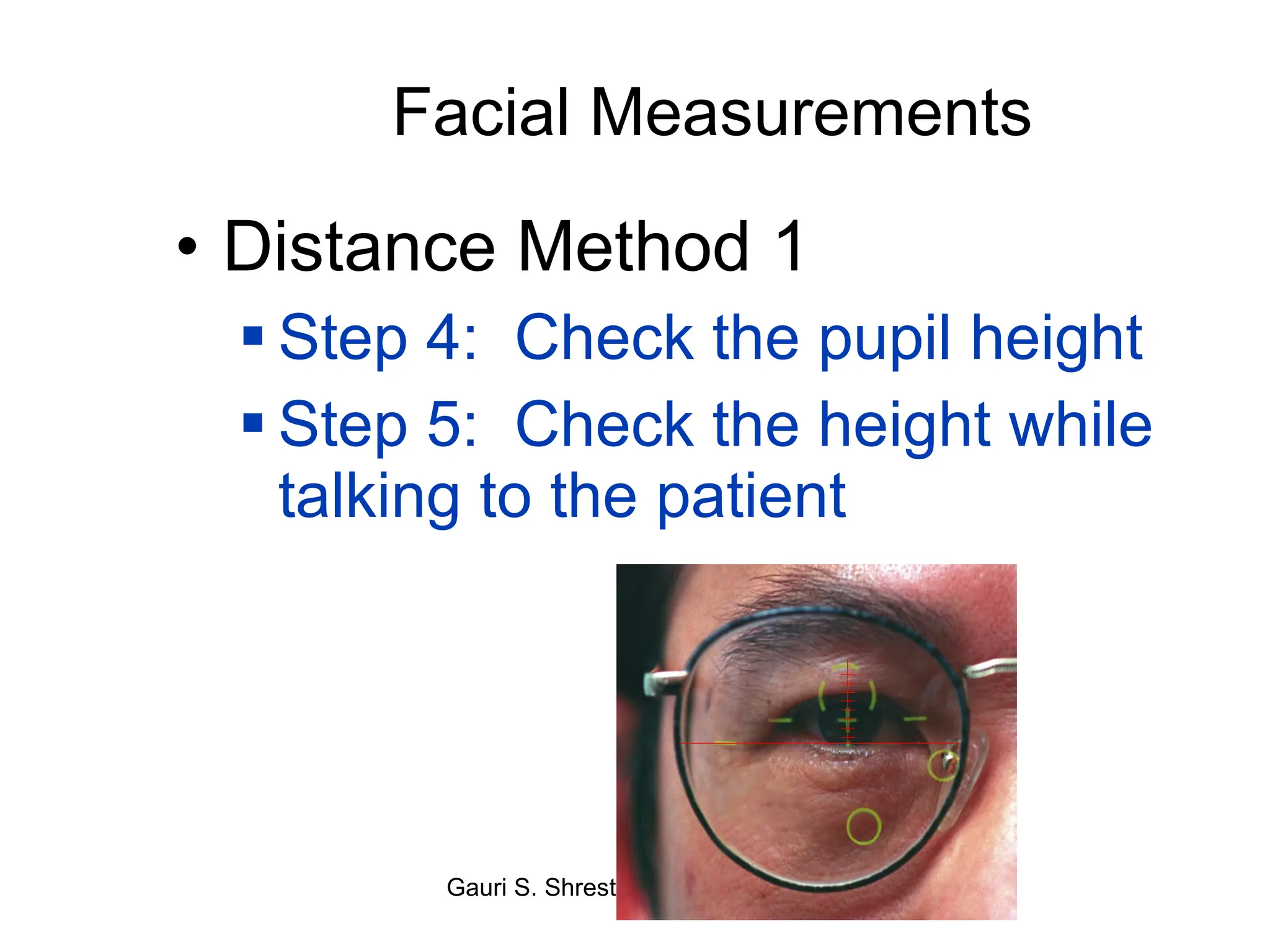 Facial Measurements Distance Method 1 Step 4:  Check the pupil height Step 5:  Check the height while talking to the patient 