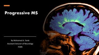 Progressive MS
By Mohamed A. Tarek
Assistant lecturer of Neurology
FEBN
 