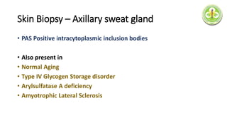 Skin Biopsy – Axillary sweat gland
• PAS Positive intracytoplasmic inclusion bodies
• Also present in
• Normal Aging
• Type IV Glycogen Storage disorder
• Arylsulfatase A deficiency
• Amyotrophic Lateral Sclerosis
 