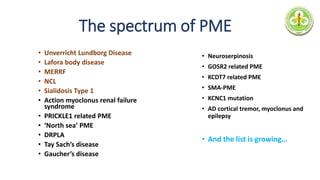The spectrum of PME
• Unverricht Lundborg Disease
• Lafora body disease
• MERRF
• NCL
• Sialidosis Type 1
• Action myoclonus renal failure
syndrome
• PRICKLE1 related PME
• ‘North sea’ PME
• DRPLA
• Tay Sach’s disease
• Gaucher’s disease
• Neuroserpinosis
• GOSR2 related PME
• KCDT7 related PME
• SMA-PME
• KCNC1 mutation
• AD cortical tremor, myoclonus and
epilepsy
• And the list is growing…
 