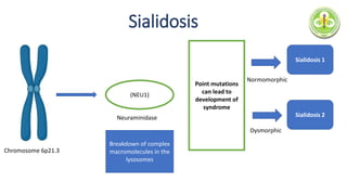 Chromosome 6p21.3
(NEU1)
Neuraminidase
Point mutations
can lead to
development of
syndrome
Breakdown of complex
macromolecules in the
lysosomes
Normomorphic
Dysmorphic
Sialidosis 1
Sialidosis 2
Sialidosis
 