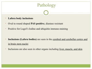 Pathology
• Lafora body inclusions
• Oval to round shaped PAS positive, diastase resistant
• Positive for Lugol’s Iodine and ubiquitin immune-staining
• Inclusions (Lafora bodies) are seen in the cerebral and cerebellar cortex and
in brain stem nuclei
• Inclusions are also seen in other organs including liver, muscle, and skin
 