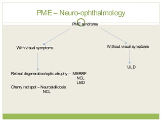 PME – Neuro-ophthalmology
PME syndrome
Retinal degeneration/optic atrophy – MERRF
NCL
LBD
Cherry red spot – Neurosialidosis
NCL
With visual symptoms Without visual symptoms
ULD
 