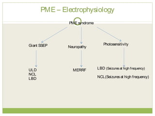 PME – Electrophysiology
PME syndrome
ULD
NCL
LBD
Giant SSEP Photosensitivity
LBD (Seizuresat high frequency)
NCL(Seizuresat high frequency)
Neuropathy
MERRF
 