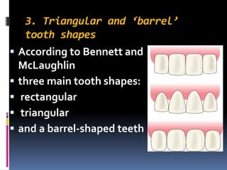 3. Triangular and ‘barrel’ 
tooth shapes 
 According to Bennett and 
McLaughlin 
 three main tooth shapes: 
 rectangular 
 triangular 
 and a barrel-shaped teeth 
 