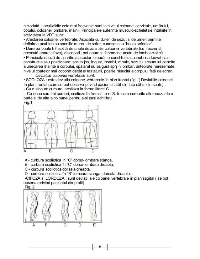 Dureri de spate mai mici la femeile din stanga