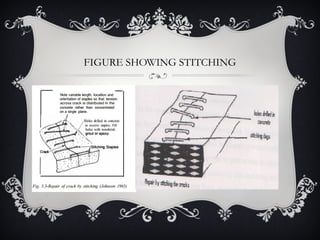 FIGURE SHOWING STITCHING
 