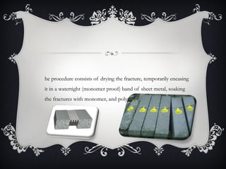 he procedure consists of drying the fracture, temporarily encasing
it in a watertight (monomer proof) band of sheet metal, soaking
the fractures with monomer, and polymerizing the monomer
 