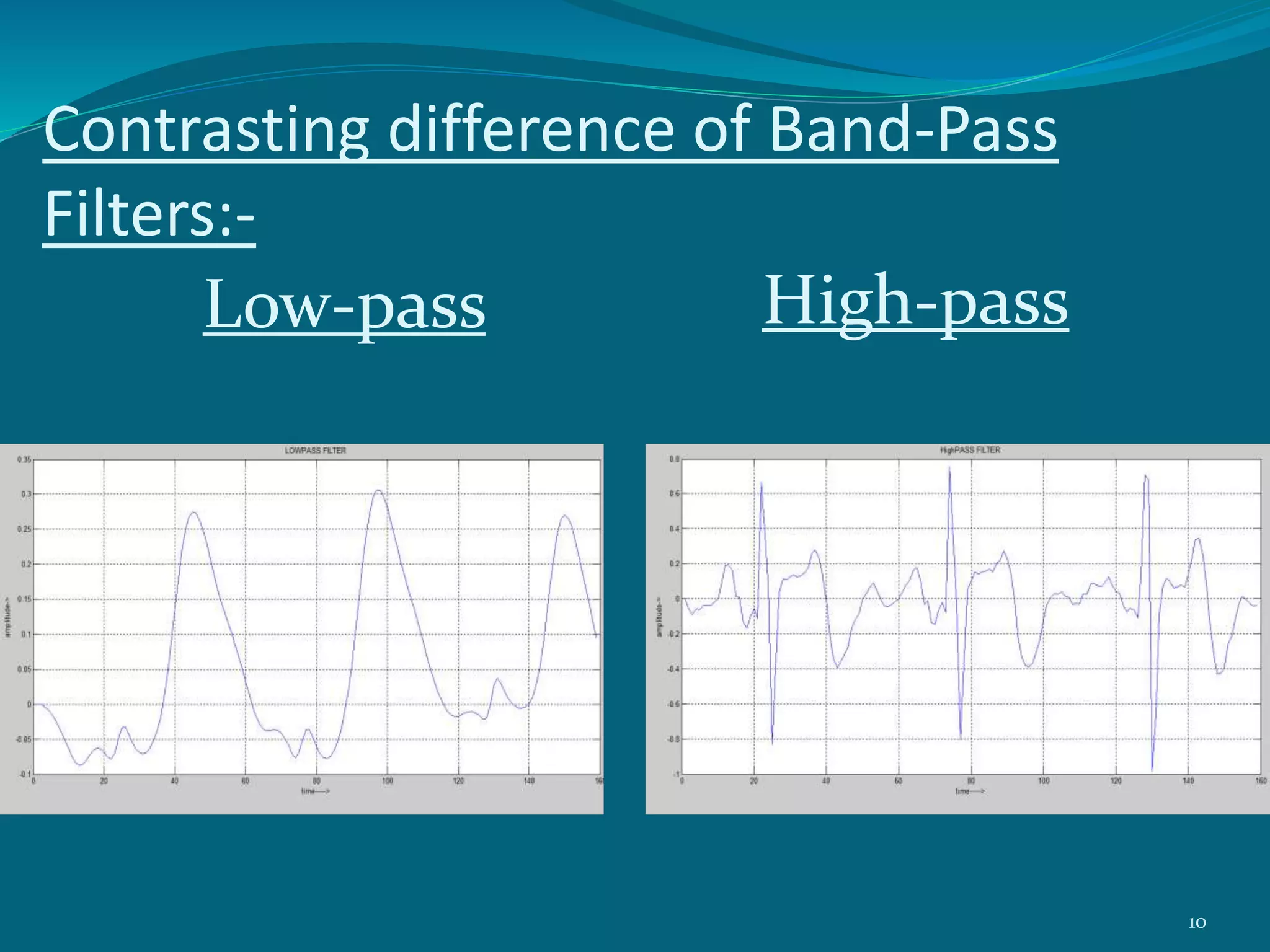 Contrasting difference of Band-Pass
Filters:-
Low-pass High-pass
10
 
