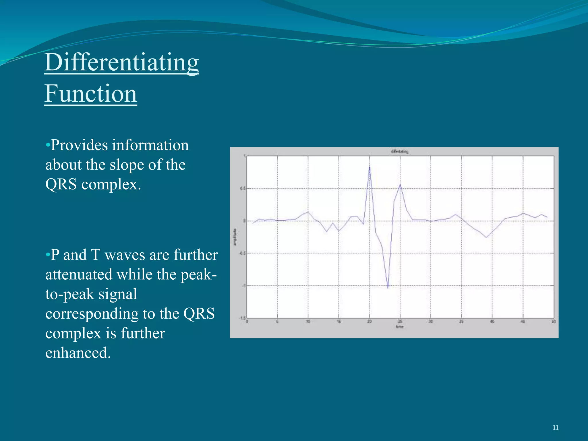 Differentiating
Function
•Provides information
about the slope of the
QRS complex.
•P and T waves are further
attenuated while the peak-
to-peak signal
corresponding to the QRS
complex is further
enhanced.
11
 
