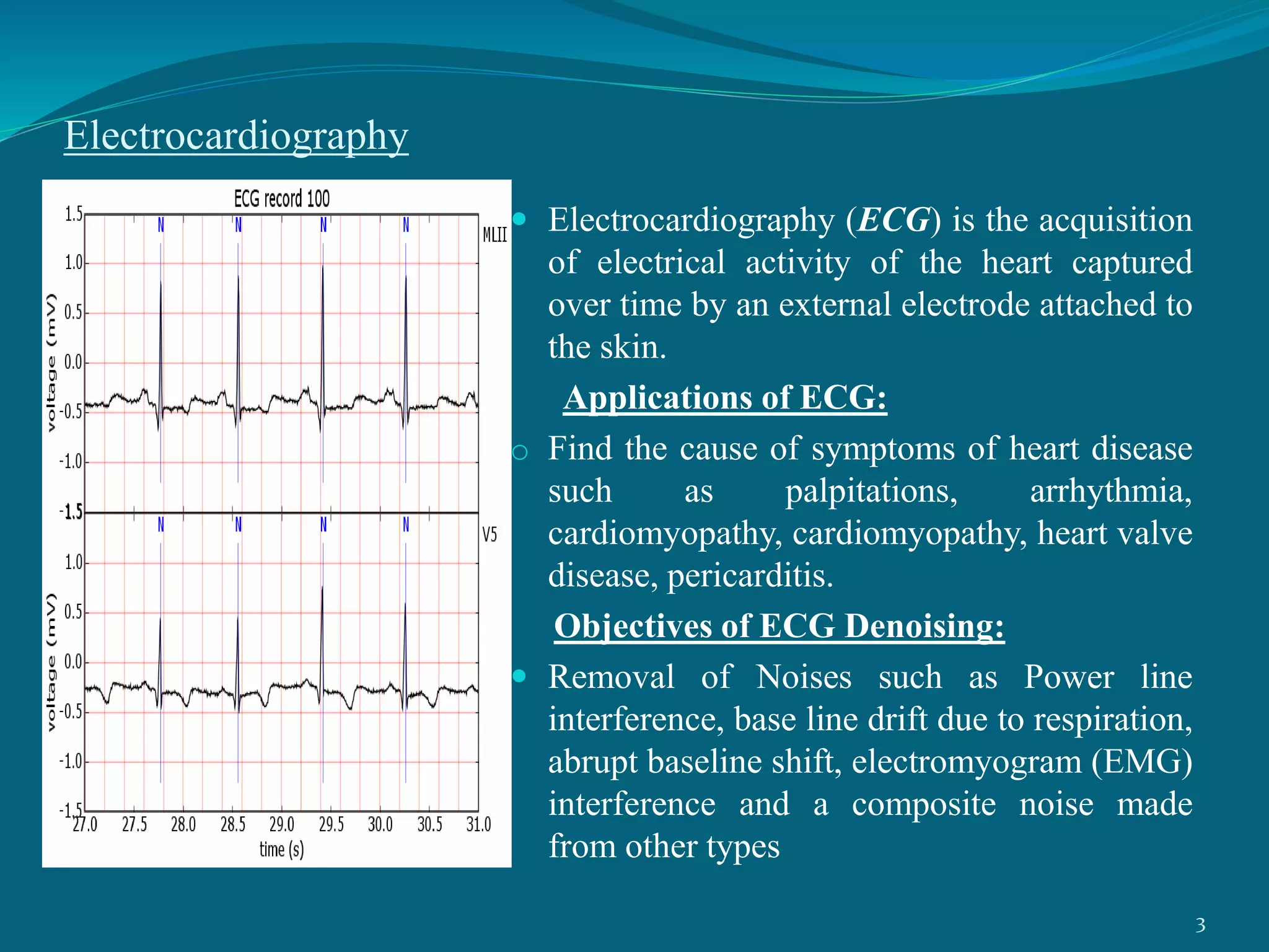 Electrocardiography
 Electrocardiography (ECG) is the acquisition
of electrical activity of the heart captured
over time by an external electrode attached to
the skin.
Applications of ECG:
o Find the cause of symptoms of heart disease
such as palpitations, arrhythmia,
cardiomyopathy, cardiomyopathy, heart valve
disease, pericarditis.
Objectives of ECG Denoising:
 Removal of Noises such as Power line
interference, base line drift due to respiration,
abrupt baseline shift, electromyogram (EMG)
interference and a composite noise made
from other types
3
 